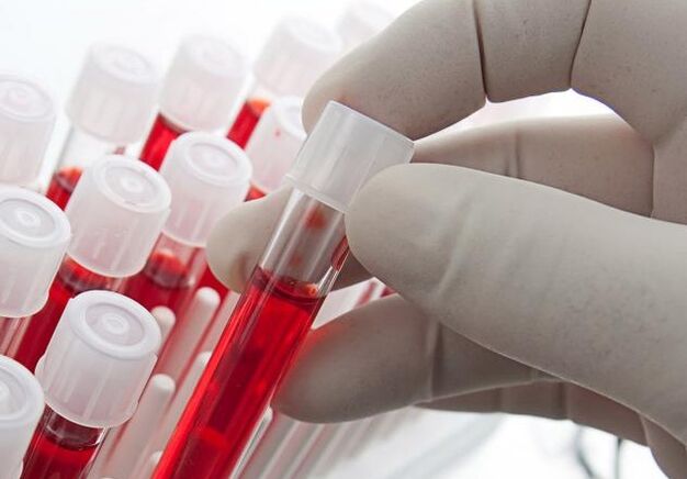 Prise de sang après avoir bu de l'alcool